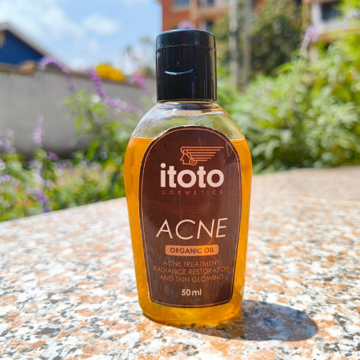 Itoto Acne Oil 50ml
